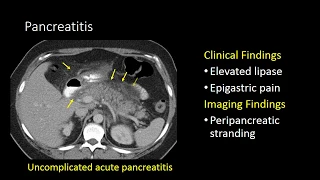 GI Imaging - Pancreatitis