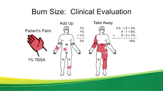 Acute Burn Injuries - Dr. Kwan