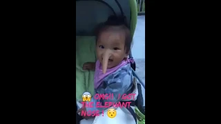 😱 Baby with an elephant nose !!🤗
