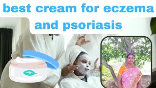best cream for eczema and psoriasis | herbal cream for skin problem....