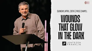 Wounds That Glow In The Dark | Jentezen Franklin