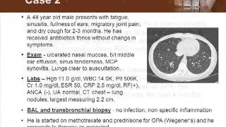 Detecting Vasculitis Before It's Too Late