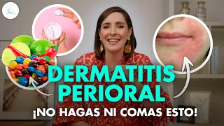 🔴 DERMATITIS PERIORAL ¡GRANITOS o IRRITACIÓN  ALREDEDOR de la BOCA! @drapilarochoa - Dermatologa