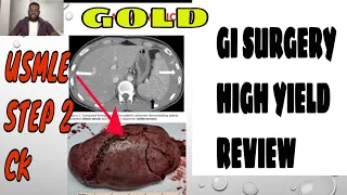 USMLE: High Yield GI Surgery Review for Usmle STEP 2 CK and Shelf || Part 1