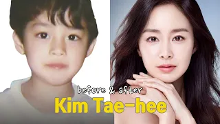 Kim Tae-hee before and after