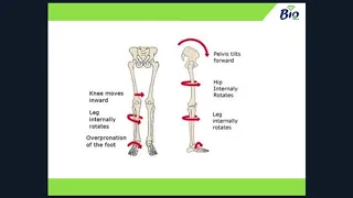 WEBINAR: Knee Pain & Orthoses