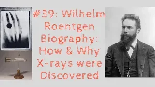 Wilhelm Roentgen Biography: How & Why X-rays were Discovered