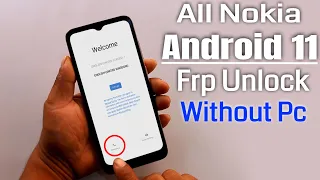 All Nokia Android 11 Bypass Google Account Lock/Reset FRP 2021 App Not Install Solution Without Pc