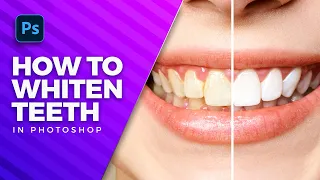How to whiten teeth in photoshop in TWO STEPS !!