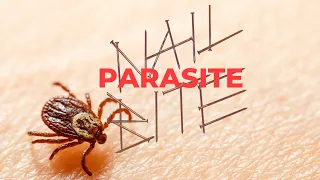 Nail Bite: Parasite official lyric video