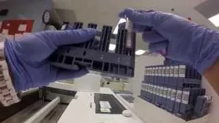 Behind the scenes: What happens to a blood sample?