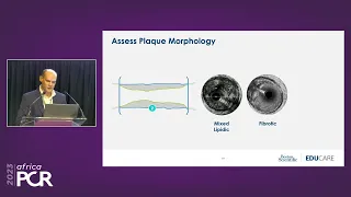 The importance of IVUS in optimising PCI of the left main coronary artery - AfricaPCR 2023