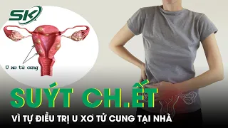 Tự Điều Trị U Xơ Tử Cung, Người Phụ Nữ Nguy Hiểm Tính Mạng | SKĐS