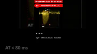 Prosthetic Aortic Valve Evaluation