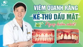 Cách Phòng Ngừa Và Hướng Điều Trị Bệnh Viêm Quanh Răng