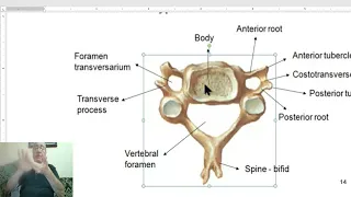 Anatomy of head and neck module in Arabic 15  (Anatomy of cervical vertebrae) , by Dr. Wahdan