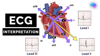 How to Read an ECG | ECG Interpretation | EKG | OSCE Guide | UKMLA | CPSA