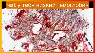 у тиктока низкий гемоглобин | подборка мемов