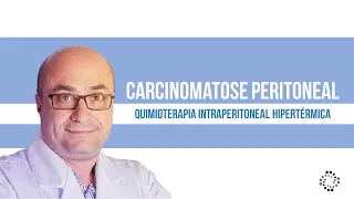 Quimioterapia Intraperitoneal Hipertérmica (HIPEC) | Dr. Arnaldo Urbano