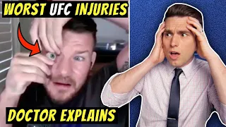 Worst UFC Injuries EVER! Doctor Explains SHOCKING Michael Bisping Eye Injury Story