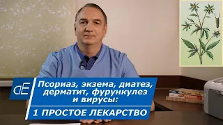 Псориаз, ЭКЗЕМА, диатез, ДЕРМАТИТ, простуда и ВИРУСЫ = 1 простое лечение. Череда, её применение.