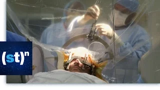 Brain Surgery Performed While Awake | SciTech Now