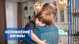 Осложнение ангины (паратонзиллярный абсцесс)