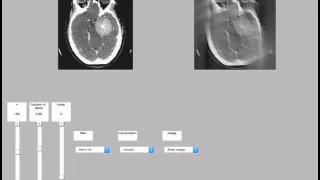 Filtered back projection (X-ray CT) Hann