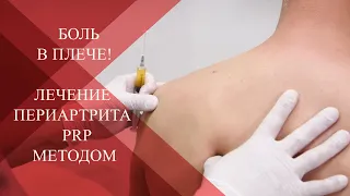 💉Как лечить плечелопаточный периартрит PRP методом по триггерным точкам| Как снять БОЛЬ в плече