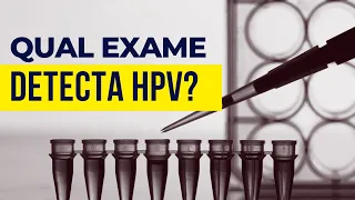 Qual exame fazer para saber se tem HPV?