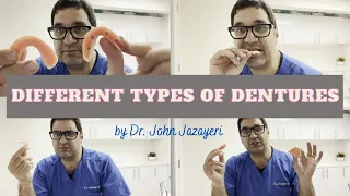 Different Types of Dentures: Which is Right for Your Mouth? Full, Partial, Immediate & More