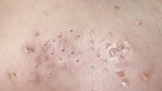 Satisfying Relaxing with Sac Dep Spa Video (#129)