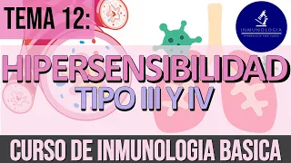 Hipersensibilidad tipo 3 y 4 | Deposito de inmnunocomplejos - Hipersensibilidad retardada