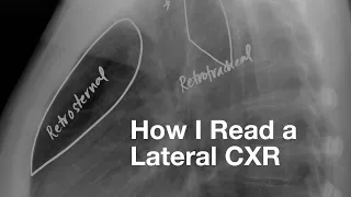 How I Read a Lateral CXR