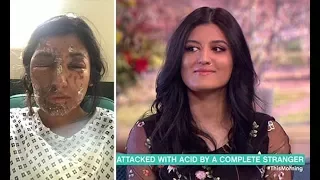 Aspiring model doused with acid appears for first time