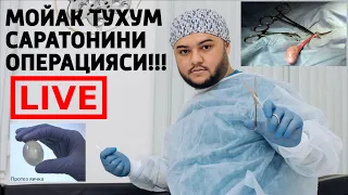 ТУХУМ КАСАЛЛИГИ 2 кисм