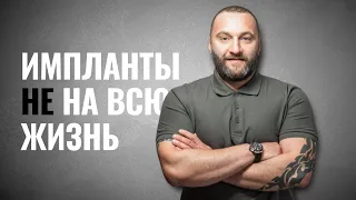 🇺🇦 Что такое зубной имплант и нужно ли его устанавливать?