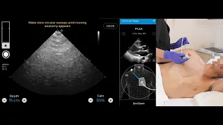 Artificial Intelligence (AI)–Guided Echocardiography