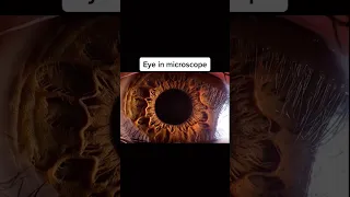 how things see in microscope
