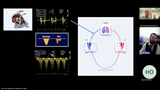 Right Ventricular Injury Patterns in Critical Care: Cases