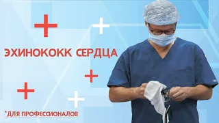 Эхинококк сердца (для профессионалов)