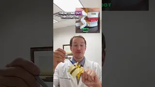 𝑺𝑪𝑰𝑨𝑻𝑰𝑪𝑨 𝑴𝑨𝑫𝑬 𝑺𝑰𝑴𝑷𝑳𝑬 (Spine Surgeon Explains)