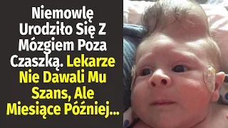 Lekarze Byli W Szoku, Gdy Zobaczyli To Niemowlę. Okazało Się, Że W Jego Głowie...