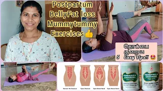 தொப்பை குறைய 5 எளிய Tips!! | Bellyfat Exercises 🤩 | How to cure Diastisis Recti👍 Postpartum Belly
