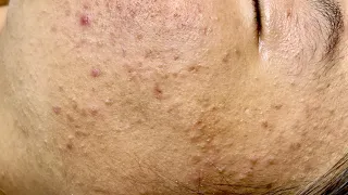 Satisfying video with Chung Vo Spa | 275