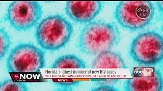 Florida: HIV cases on the rise