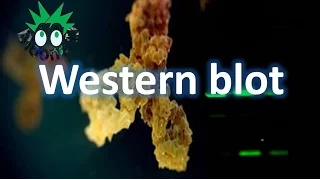 Western blot-Imuno blot