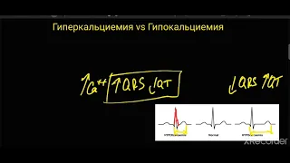 Гиперкальциемия и Гипокальциемия. ЭКГ