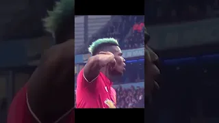 Pogba refused surgery because of the World Cup