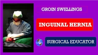 INGUINAL HERNIA-How To DIAGNOSE & TREAT/ Groin Swellings